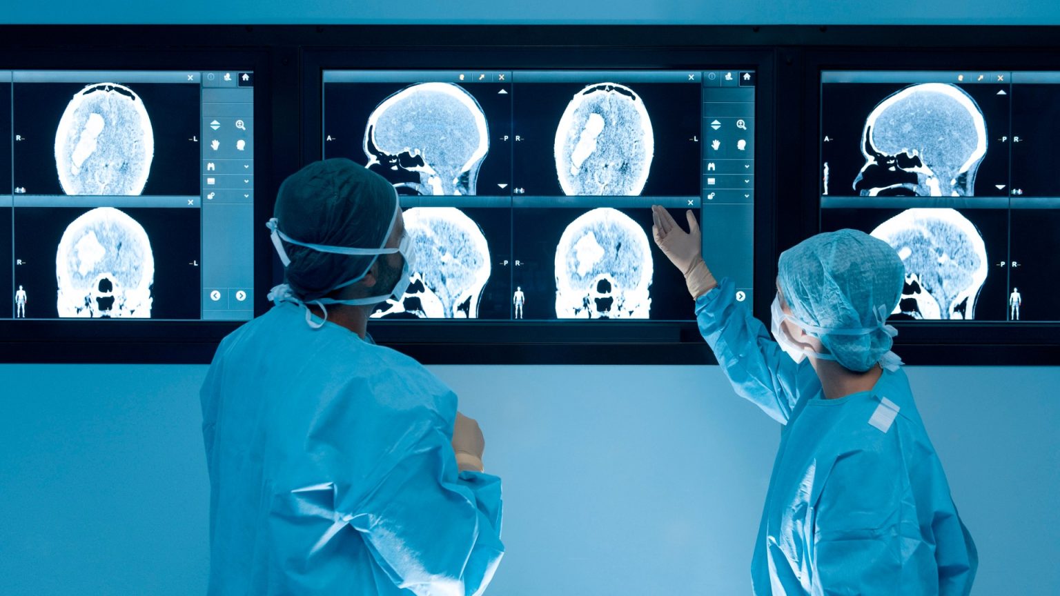 Common Virus Implicated in Alzheimer’s Disease Development: Potential Gut-Brain Axis Involvement.