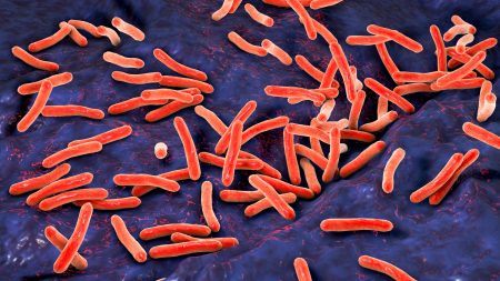 Medieval Disease Causing Victims to Cough Up Blood Sees 11% Surge in UK, Warnings Issued