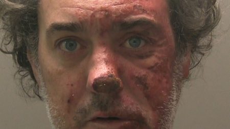 Man imprisoned for killing former partner who tragically passed away two years after being engulfed in flames in a horrific assault.