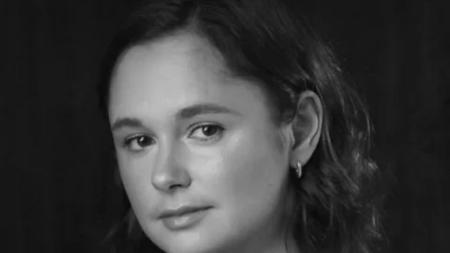 Severe Allergic Reaction Following a Kiss in Nightclub Requires Hospitalization