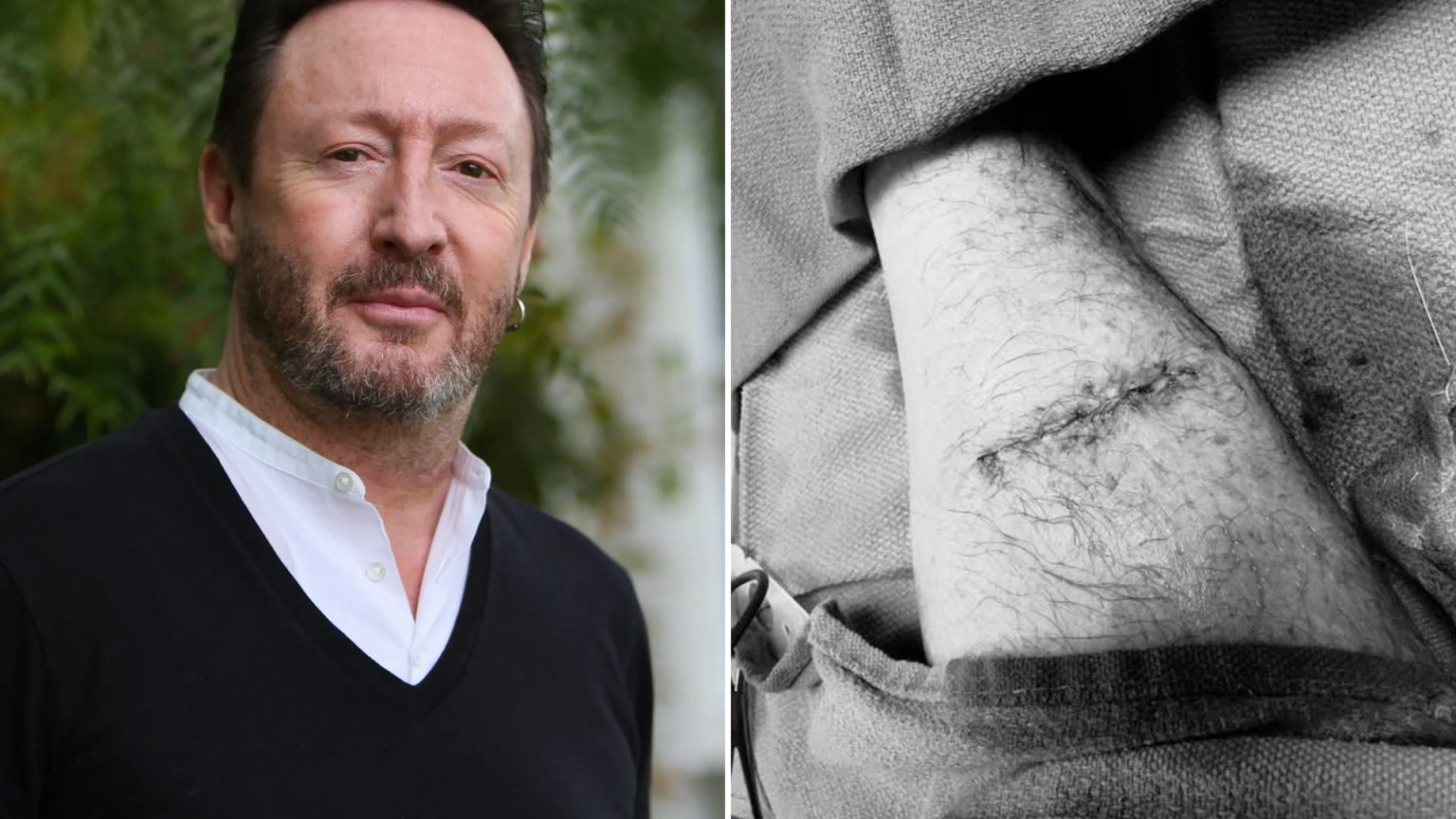 Julian Lennon Discloses Cancer Diagnosis and Subsequent Life-Saving Emergency Surgery.