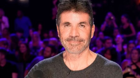 Has Simon Cowell had plastic surgery?