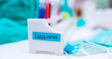 Bleeding eye virus Lassa fever could be in UK after case arrived from Nigeria