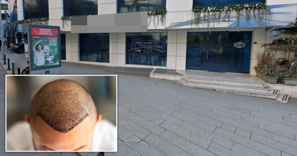 British tourist, 38, dies after Turkey hair transplant goes wrong