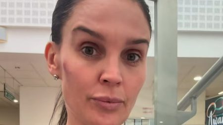 Danielle Lloyd back in hospital for new cancer op as she hits out at stars who spread misinformation over SPF