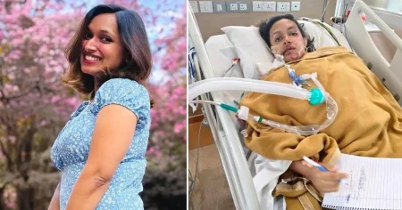 Woman loses part of her face in tractor crash abroad after being told to go away to ‘cure depression’