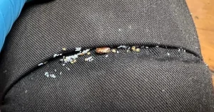 Mutant bed bugs on the rise in UK after building resistance to insecticides