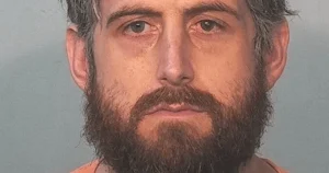 Man charged with arson ‘cut off his own genitals and set fire to them’