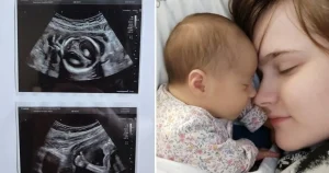 ‘I was warned my baby wouldn’t survive birth – then she gave me a sign in a scan’